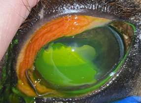 Ophthalmology- stained corneal ulcer